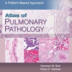 Atlas of Pulmonary Pathology: A Pattern Based Approach 1st Edition PDF Free Download