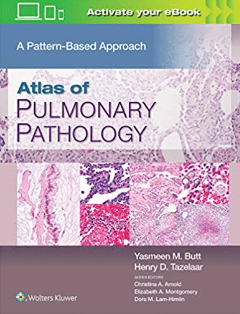 Atlas of Pulmonary Pathology: A Pattern Based Approach 1st Edition PDF Free Download