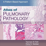 Atlas of Pulmonary Pathology: A Pattern Based Approach PDF Free Download