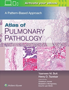 Atlas of Pulmonary Pathology: A Pattern Based Approach PDF Free Download