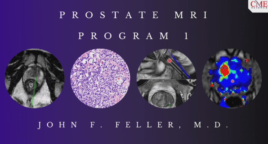 CME Science : Prostate MRI (Program 1) 2021 Videos and PDF Free Download