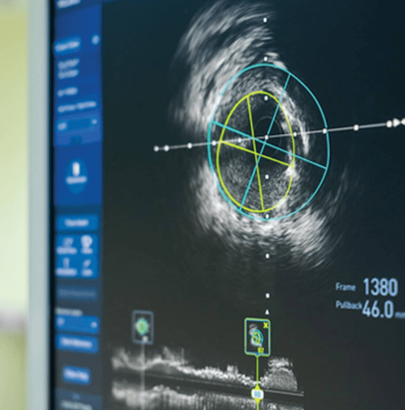 Download A Comprehensive Review of Vascular Ultrasound Interpretation and Registry Preparation 2021 Free