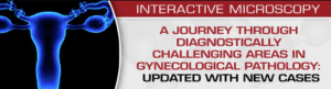 Download A Journey Through Diagnostically Challenging Areas in Gynecologic Pathology: Updated with New Cases 2019 Videos and PDF Free