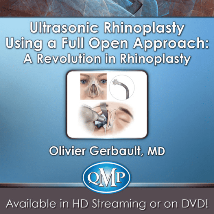 Download QMP Ultrasonic Rhinoplasty Using a Full Open Approach: A Revolution in Rhinoplasty 2018 Videos Free