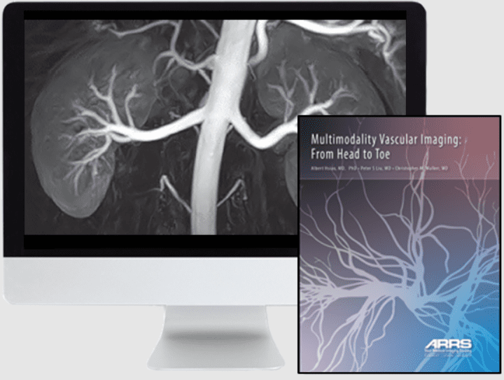 Multimodality Vascular Imaging: From Head to Toe 2020 Videos and PDF Free Download