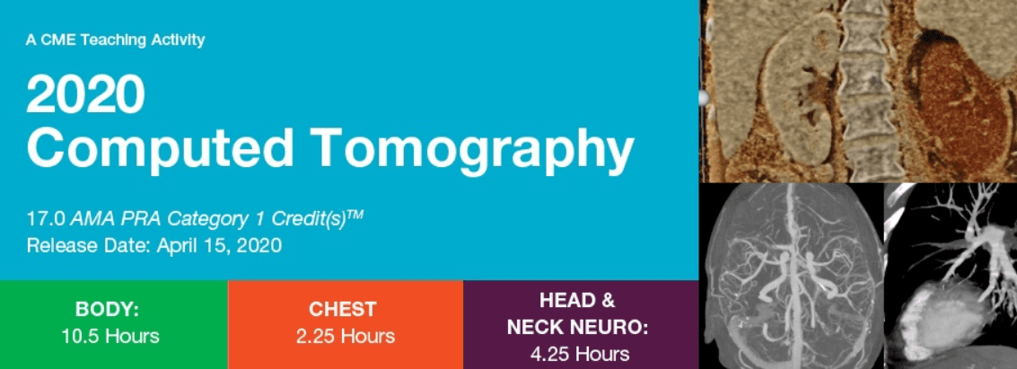 2020 Computed Tomography Videos Free Download