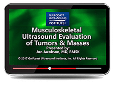 Gulfcoast: MSK Ultrasound Evaluation of Tumors and Masses Videos Free Download