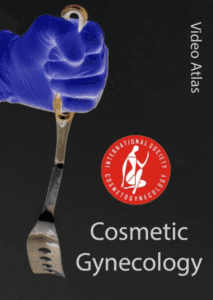 ISCG Video Atlas of Cosmetic Gynecology Videos Free Download