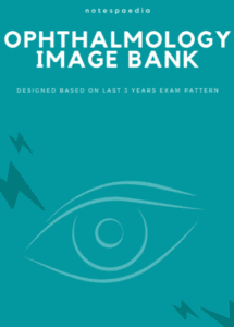 Notespaedia Ophthalmology Image Bank PDF Free Download