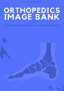 Notespaedia Orthopedics Image Bank PDF Free Download