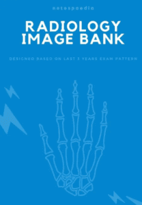 Notespaedia Radiology Image Bank PDF Free Download