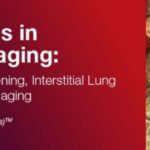 Download 2020 Updates in Thoracic Imaging: Highlighting Lung Screening, Interstitial Lung Disease, and Cardiac Imaging Videos Free