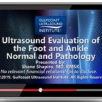Download Gulfcoast: Ultrasound Evaluation of the Foot and Ankle: Normal and Pathology Videos Free