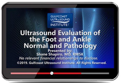 Download Gulfcoast: Ultrasound Evaluation of the Foot and Ankle: Normal and Pathology Videos Free