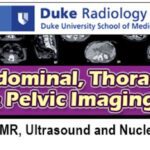 Duke Radiology Abdominal, Thoracic & Pelvic Imaging (2017) Videos Free Download