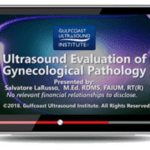 Gulfcoast: Ultrasound Evaluation of Gynecological Pathology Videos Free Download