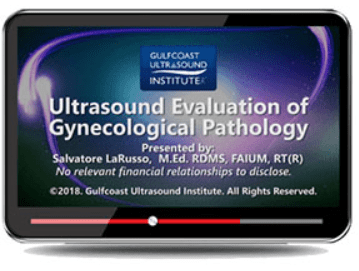 Gulfcoast: Ultrasound Evaluation of Gynecological Pathology Videos Free Download
