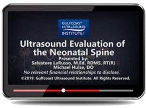 Gulfcoast: Ultrasound Evaluation of the Neonatal Spine Videos Free Download