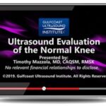 Gulfcoast: Ultrasound Evaluation of the Normal Knee Videos Free Download