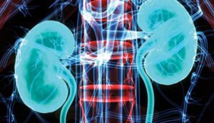 Intensive Review of Nephrology 2021 Videos Free Download