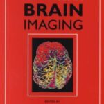 Advances in Brain Imaging PDF Free Download