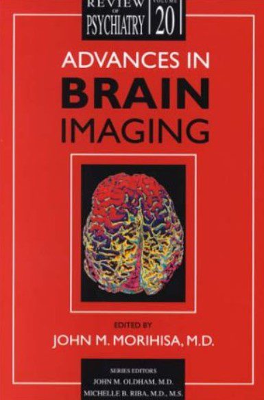 Advances in Brain Imaging PDF Free Download