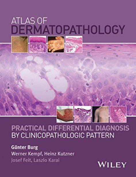 Atlas of Dermatopathology: Practical Differential Diagnosis PDF Free Download