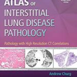 Atlas of Interstitial Lung Disease Pathology PDF Free Download