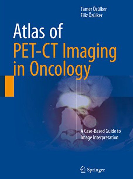 Atlas of PET-CT Imaging in Oncology PDF Free Download