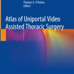 Atlas of Uniportal Video Assisted Thoracic Surgery PDF Free Download
