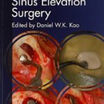 Clinical Maxillary Sinus Elevation Surgery PDF Free Download
