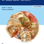 Comprehensive Management of Skull Base Tumors 2nd Edition PDF Free Download