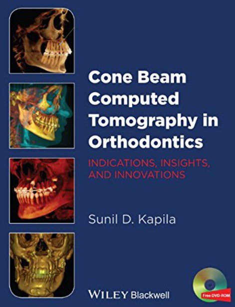 Cone Beam Computed Tomography in Orthodontics PDF Free Download