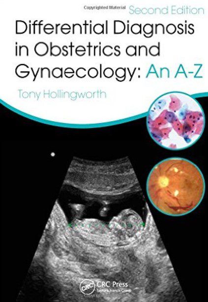 Differential Diagnosis in Obstetrics & Gynaecology: An A-Z 2nd Edition PDF Free Download