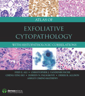 Download Atlas of Exfoliative Cytopathology : With Histopathologic Correlations PDF Free