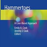 Hammertoes: A Case-Based Approach PDF Free Download