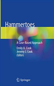 Hammertoes: A Case-Based Approach PDF Free Download
