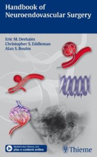 Handbook of Neuroendovascular Surgery PDF Free Download