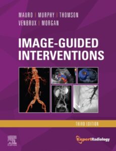 Image-Guided Interventions (Expert Radiology Series) 3rd Edition PDF Free Download