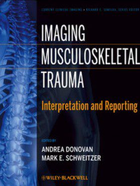 Imaging Musculoskeletal Trauma: Interpretation and Reporting PDF Free Download