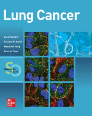 Lung Cancer: Standards of Care PDF Free Download