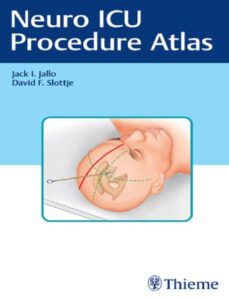 Neuro ICU Procedure Atlas PDF Free Download