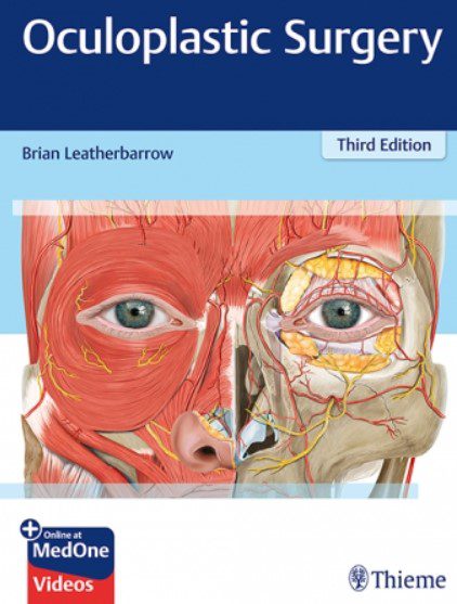 Oculoplastic surgery 3rd Edition PDF Free Download