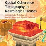 Optical Coherence Tomography in Neurologic Diseases PDF Free Download