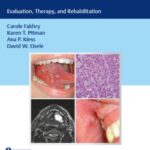 Oral Cancer: Evaluation, Therapy, and Rehabilitation PDF Free Download