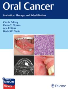 Oral Cancer: Evaluation, Therapy, and Rehabilitation PDF Free Download