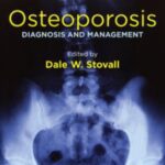 Osteoporosis: Diagnosis and Management PDF Free Download