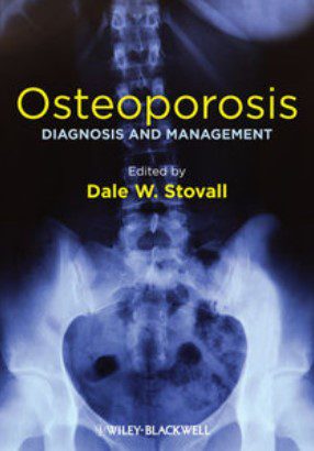 Osteoporosis: Diagnosis and Management PDF Free Download