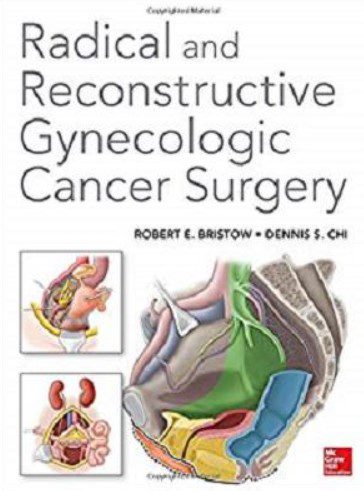 Radical and Reconstructive Gynecologic Cancer Surgery PDF Free Download