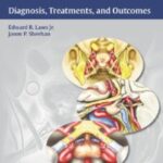 Sellar and Parasellar Tumors: Diagnosis, Treatments, and Outcomes PDF Free Download